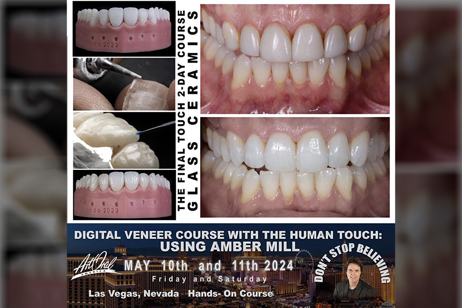 EARLY BIRD SPECIAL $1099 - TFT: Digital Veneers With The Human Touch Using Amber Mill